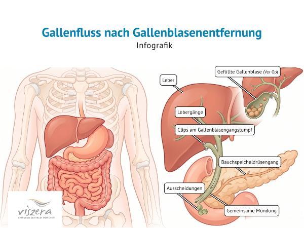 Grafik Gallenfluss.