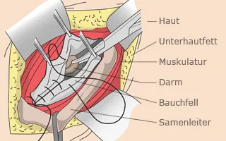 Das Wichtigste in Kürze